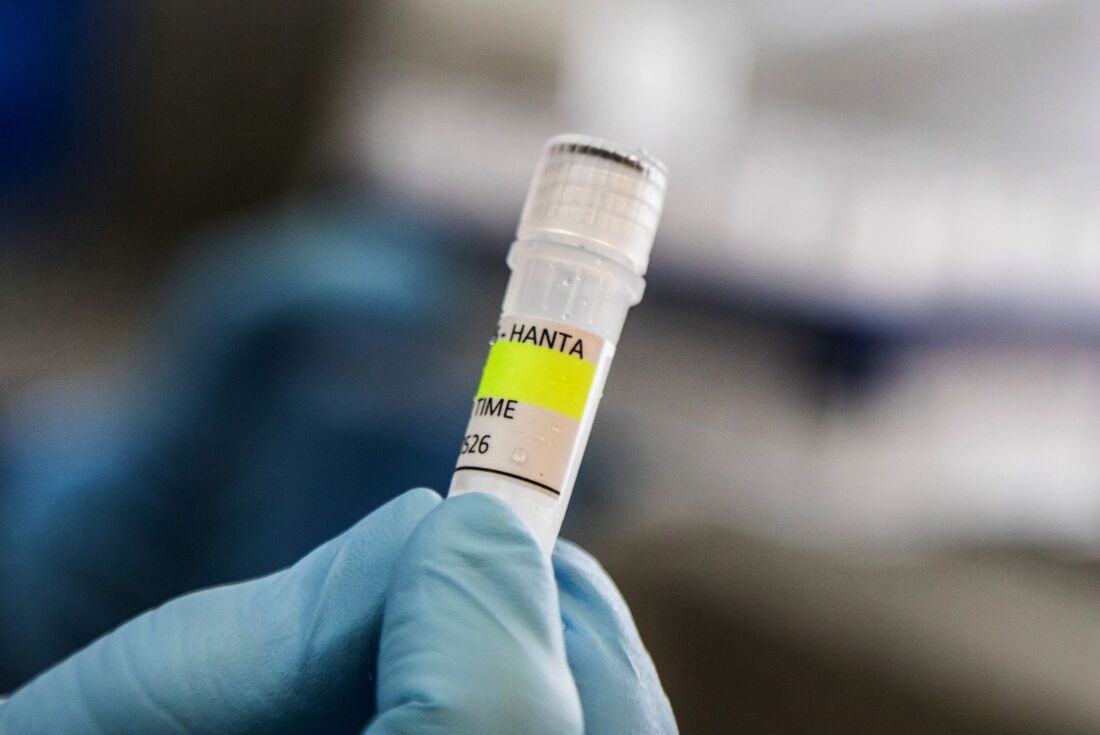 O que os cientistas argentinos sabem sobre a cepa Andes do hantavírus